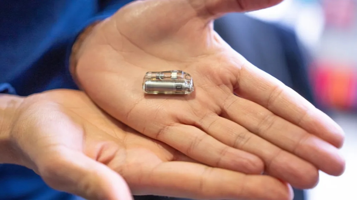 Un bébé prématuré reçoit le plus petit stimulateur cardiaque au monde à Barcelone